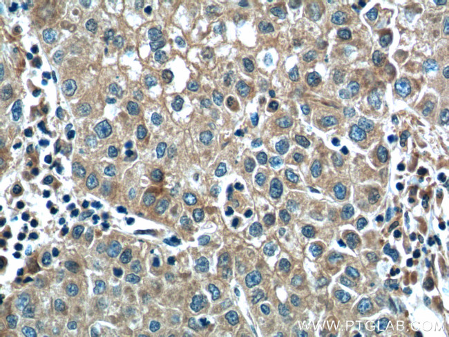 ALDH9A1 Antibody in Immunohistochemistry (Paraffin) (IHC (P))