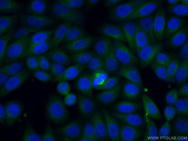 TRAF3IP2 Antibody in Immunocytochemistry (ICC/IF)