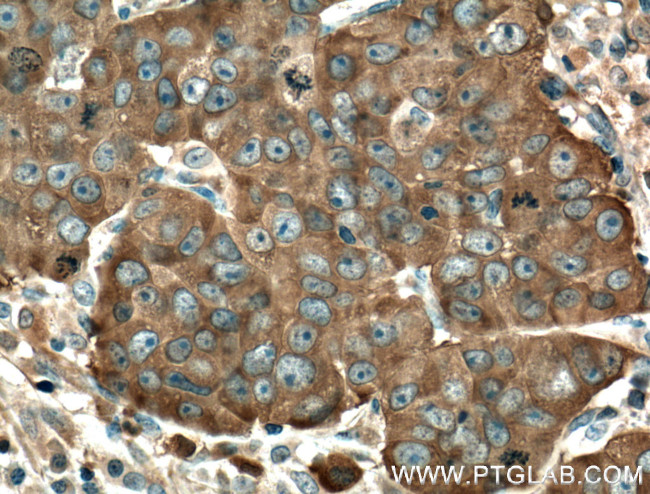 MYO6 Antibody in Immunohistochemistry (Paraffin) (IHC (P))