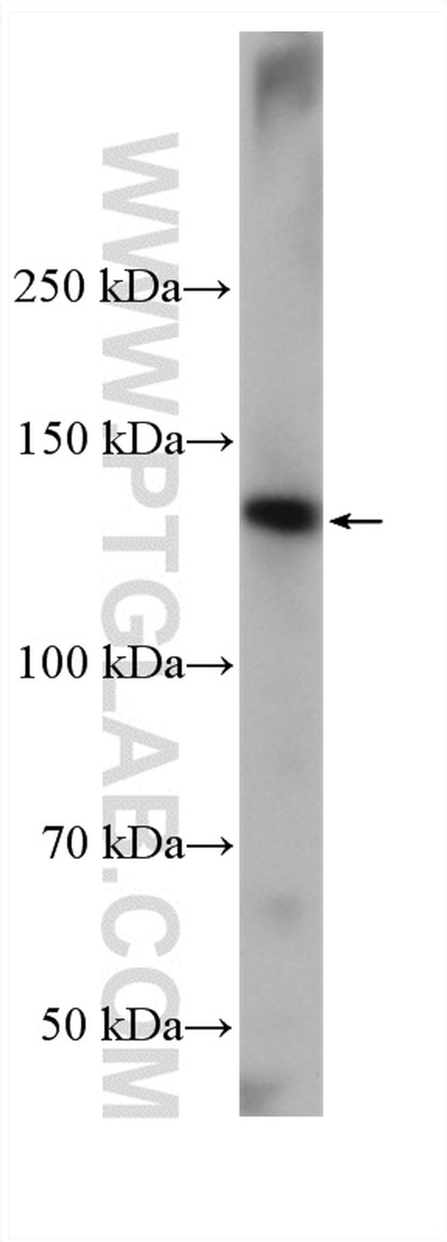 MYO6 Antibody in Western Blot (WB)