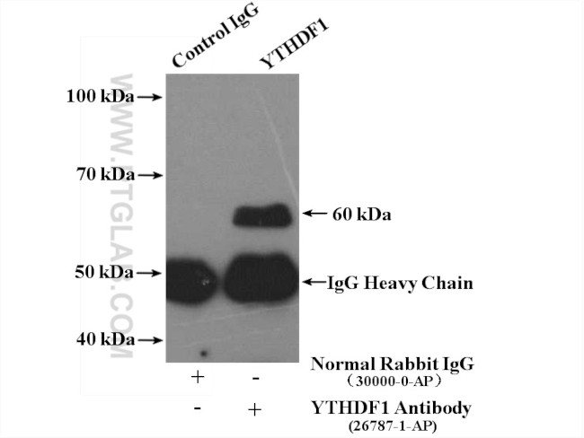 YTHDF1 Antibody in Immunoprecipitation (IP)