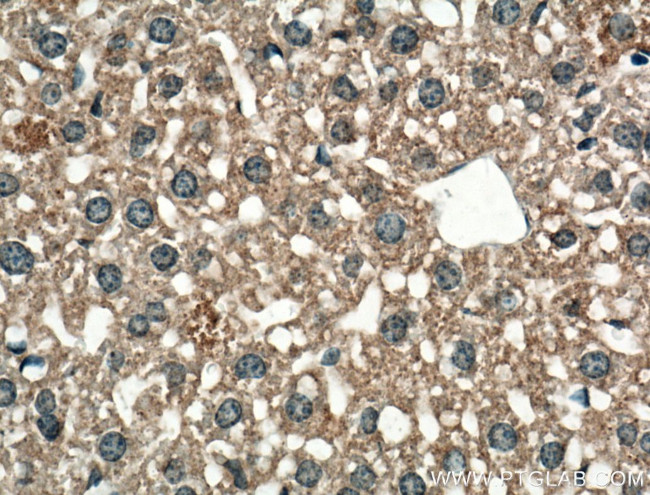 SLC22A7 Antibody in Immunohistochemistry (Paraffin) (IHC (P))