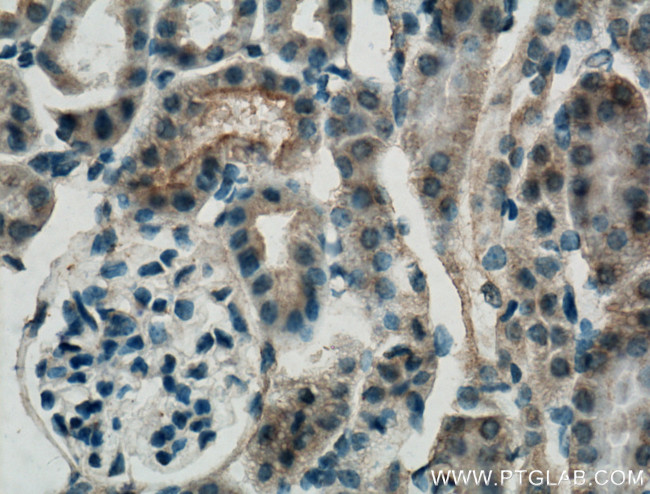 SLC22A7 Antibody in Immunohistochemistry (Paraffin) (IHC (P))