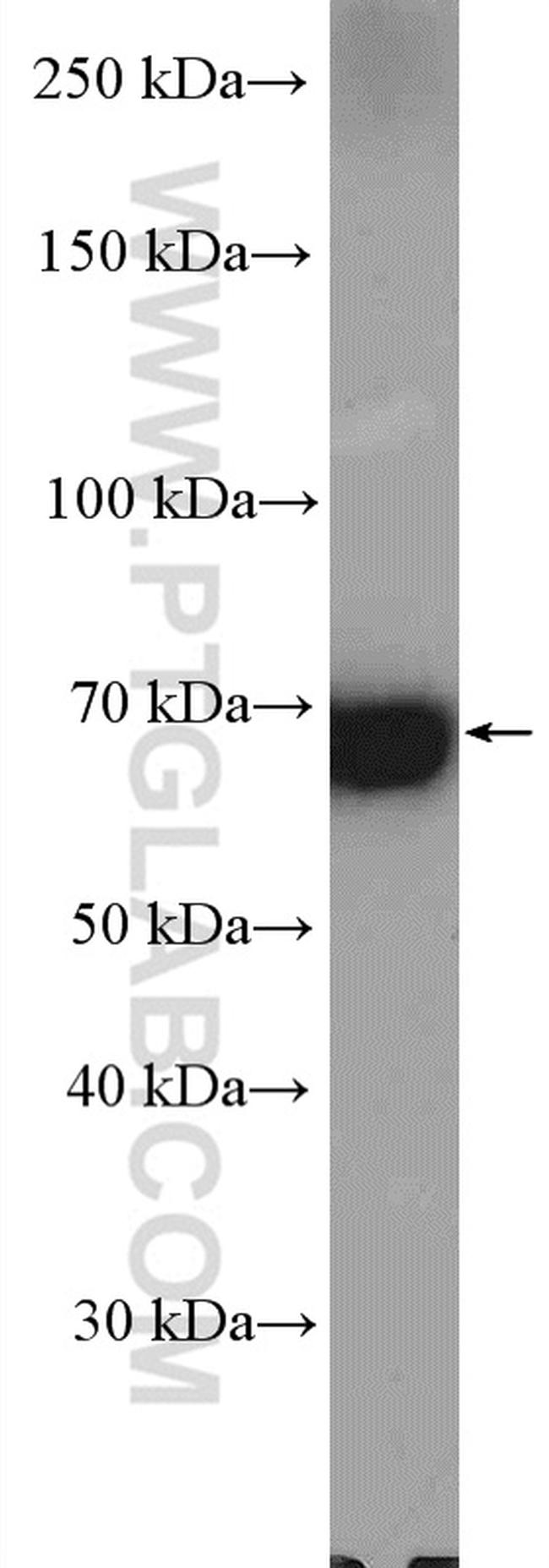 SLC22A7 Antibody in Western Blot (WB)