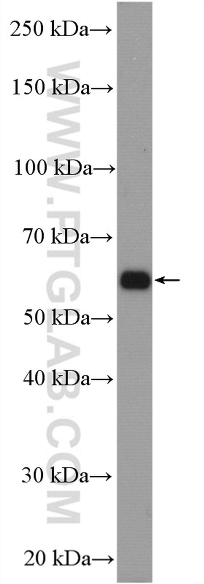SLC25A12 Antibody in Western Blot (WB)