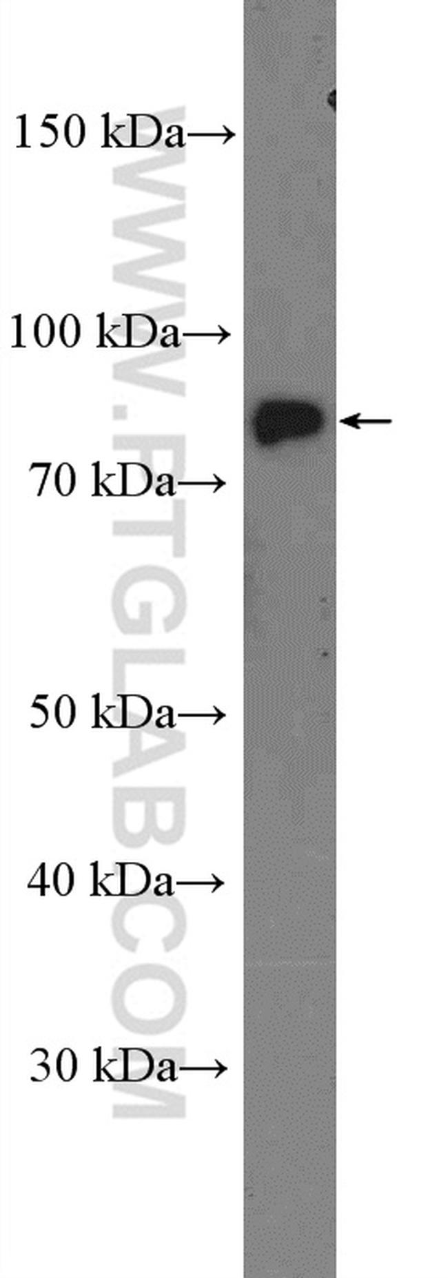 CLCN5 Antibody in Western Blot (WB)