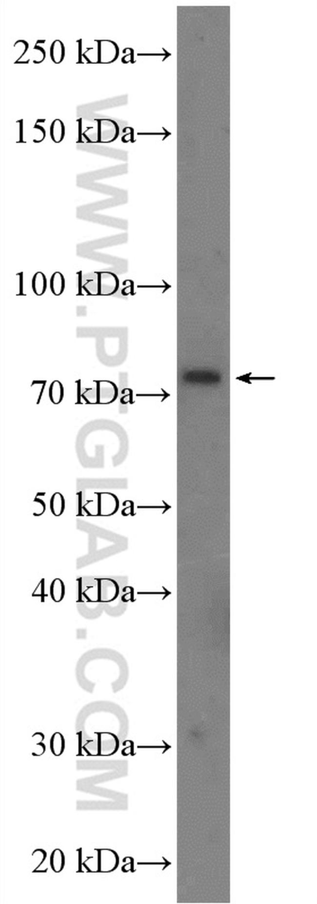 CLCN5 Antibody in Western Blot (WB)