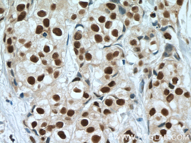 CstF-64 Antibody in Immunohistochemistry (Paraffin) (IHC (P))