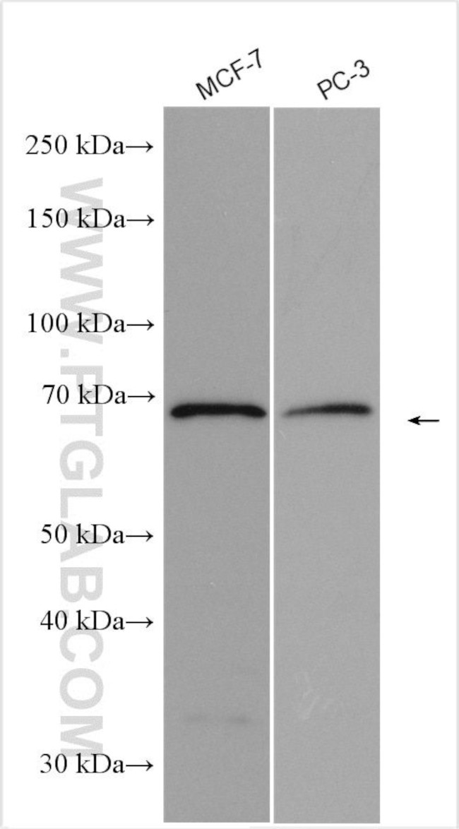 SLC22A16 Antibody in Western Blot (WB)