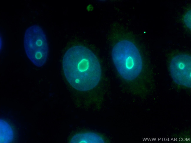 NOP14 Antibody in Immunocytochemistry (ICC/IF)