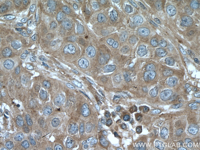 LTBP1 Antibody in Immunohistochemistry (Paraffin) (IHC (P))