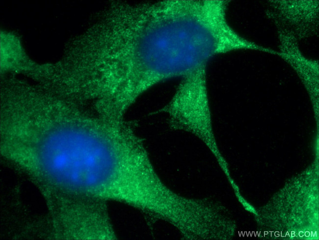 PKC zeta Antibody in Immunocytochemistry (ICC/IF)