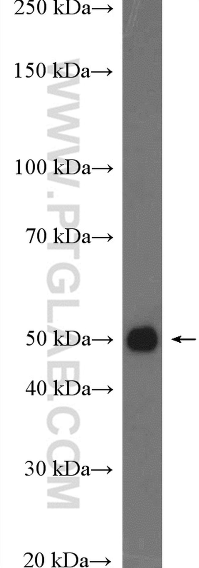 DUSP7/PYST2 Antibody in Western Blot (WB)