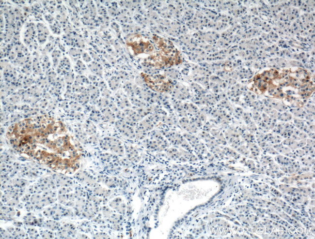 TRIM26 Antibody in Immunohistochemistry (Paraffin) (IHC (P))