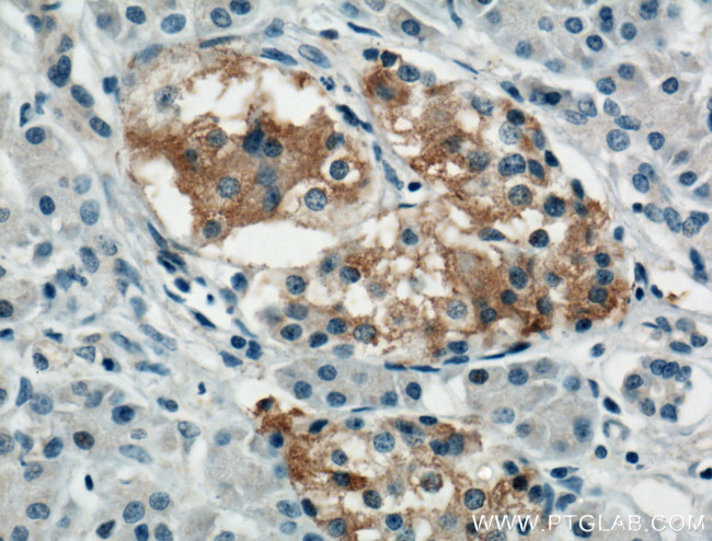 TRIM26 Antibody in Immunohistochemistry (Paraffin) (IHC (P))