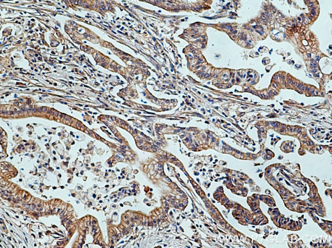 TRIM26 Antibody in Immunohistochemistry (Paraffin) (IHC (P))