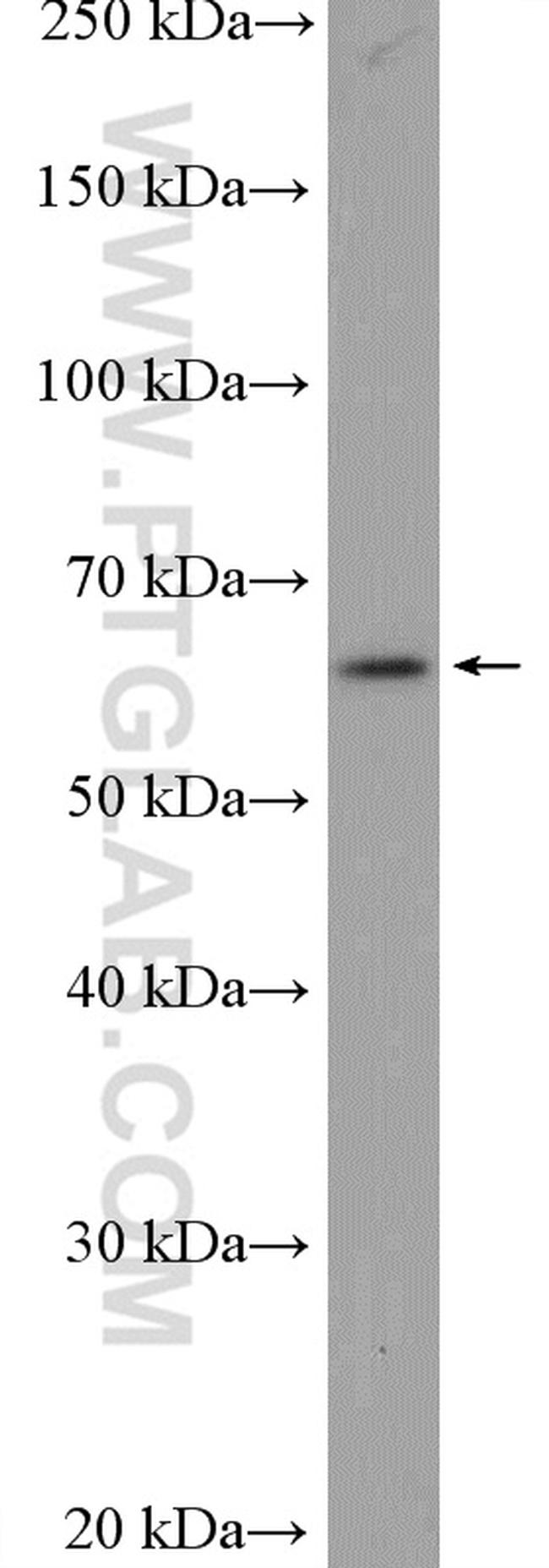 TRIM26 Antibody in Western Blot (WB)