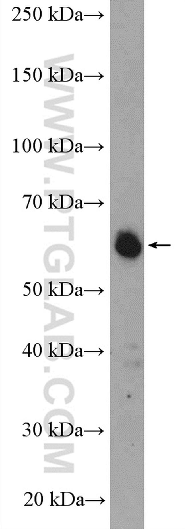 TRIM26 Antibody in Western Blot (WB)