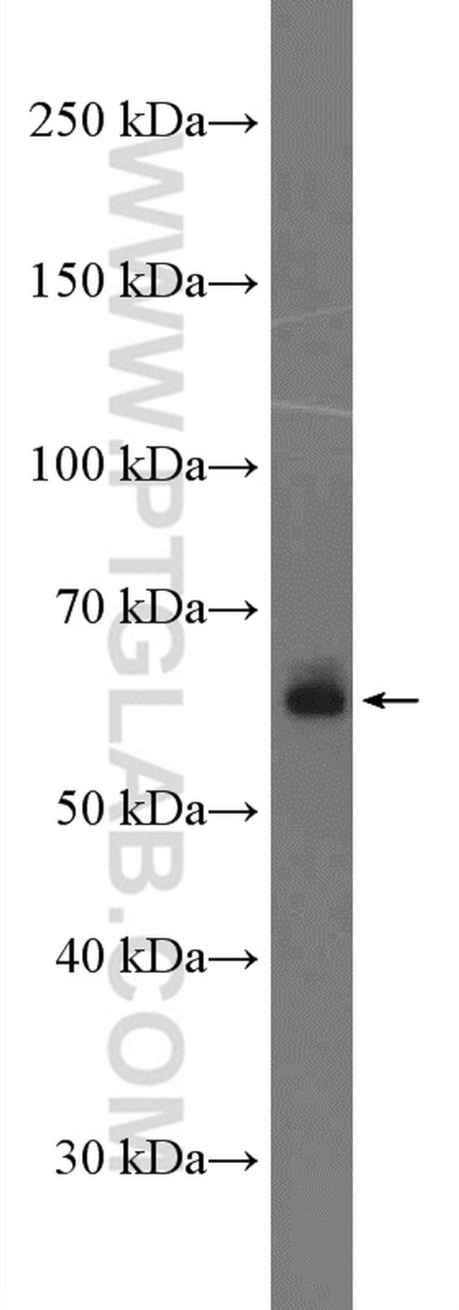 TRIM26 Antibody in Western Blot (WB)