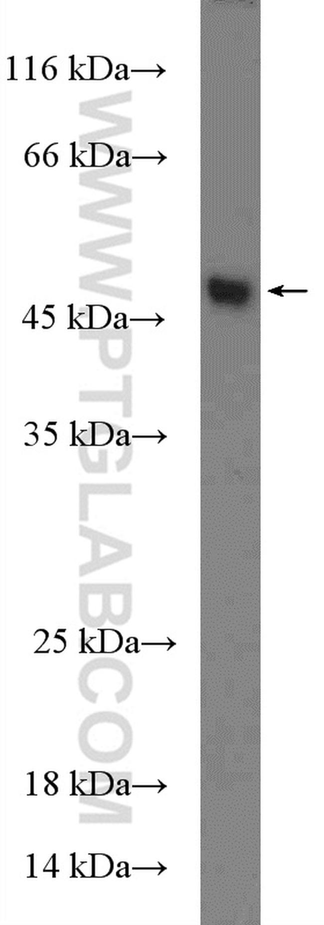 TANK Antibody in Western Blot (WB)