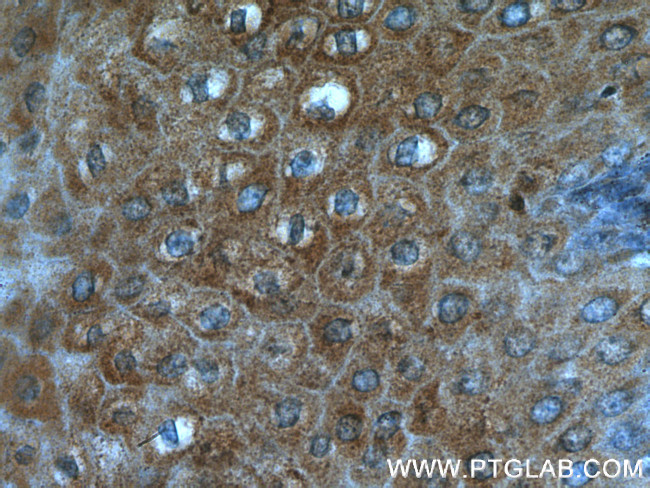 DKK4 Antibody in Immunohistochemistry (Paraffin) (IHC (P))