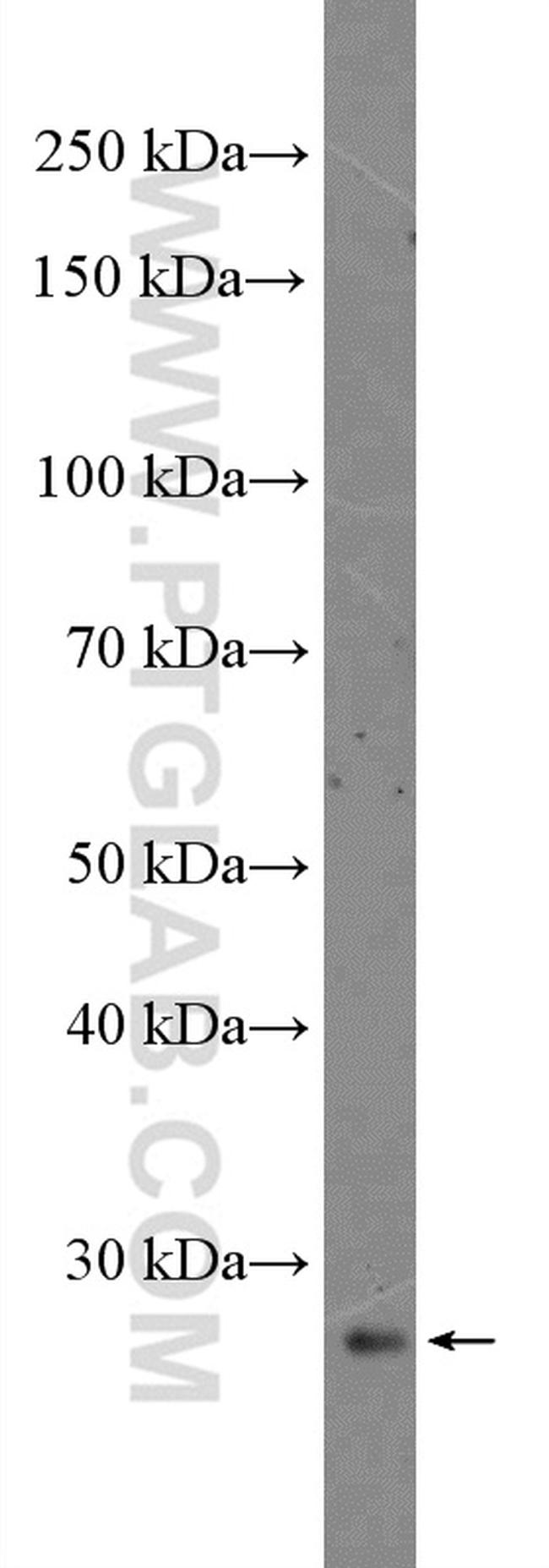 DKK4 Antibody in Western Blot (WB)