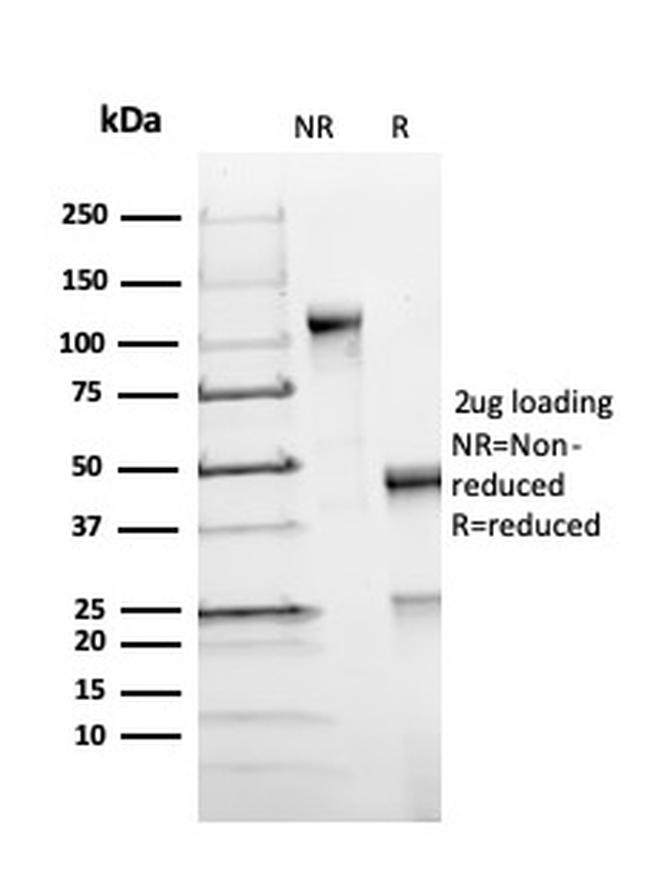 FOXP1 (Transcription Factor) Antibody in SDS-PAGE (SDS-PAGE)