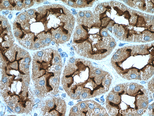 PCDH24 Antibody in Immunohistochemistry (Paraffin) (IHC (P))