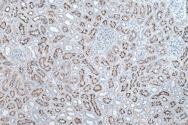 PCDH24 Antibody in Immunohistochemistry (Paraffin) (IHC (P))