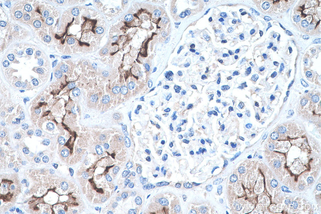 PCDH24 Antibody in Immunohistochemistry (Paraffin) (IHC (P))