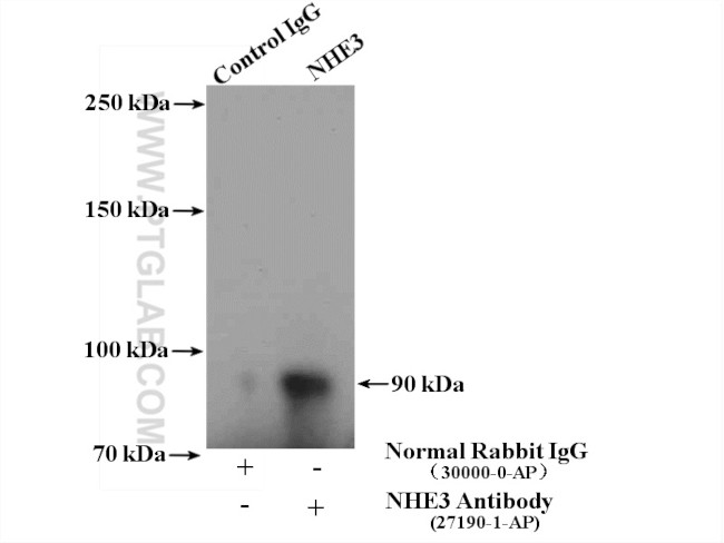 NHE3 Antibody in Immunoprecipitation (IP)