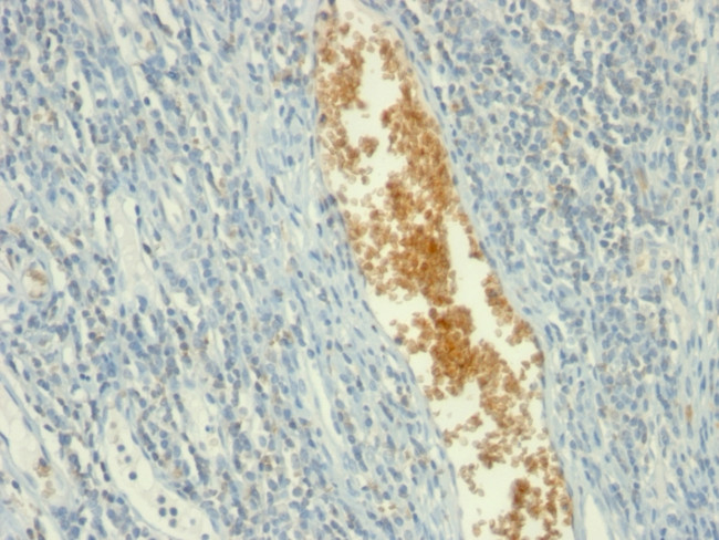 AMP Deaminase, Isoform E (AMPD3) Antibody in Immunohistochemistry (Paraffin) (IHC (P))