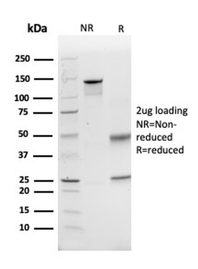 Glutamate-Cysteine Ligase Regulatory Subunit Antibody in SDS-PAGE (SDS-PAGE)