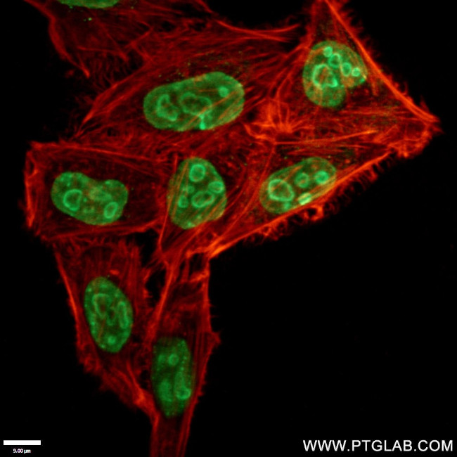 KI67 Antibody in Immunocytochemistry (ICC/IF)