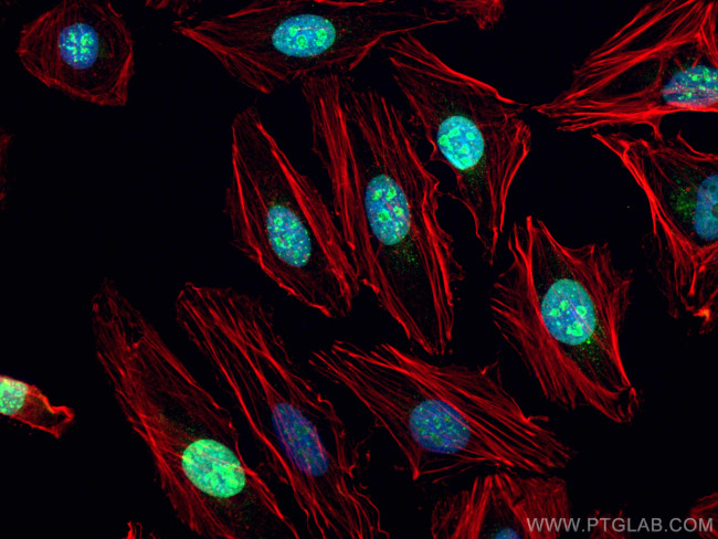 KI67 Antibody in Immunocytochemistry (ICC/IF)