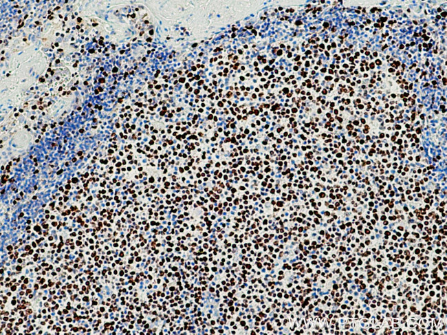 KI67 Antibody in Immunohistochemistry (Paraffin) (IHC (P))