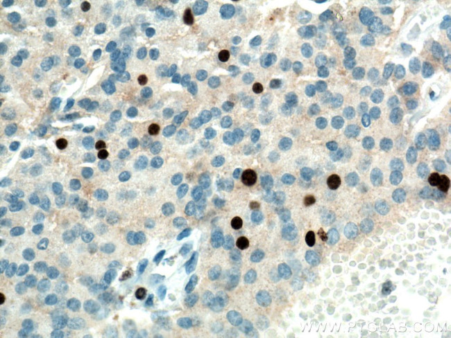 KI67 Antibody in Immunohistochemistry (Paraffin) (IHC (P))