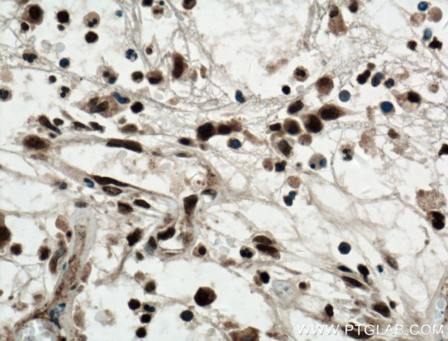 KI67 Antibody in Immunohistochemistry (Paraffin) (IHC (P))