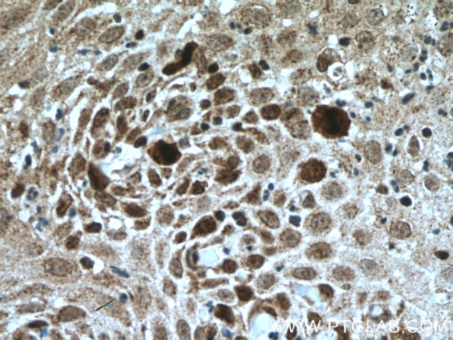 KI67 Antibody in Immunohistochemistry (Paraffin) (IHC (P))