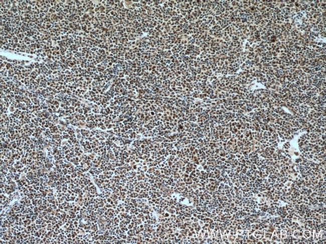 KI67 Antibody in Immunohistochemistry (Paraffin) (IHC (P))