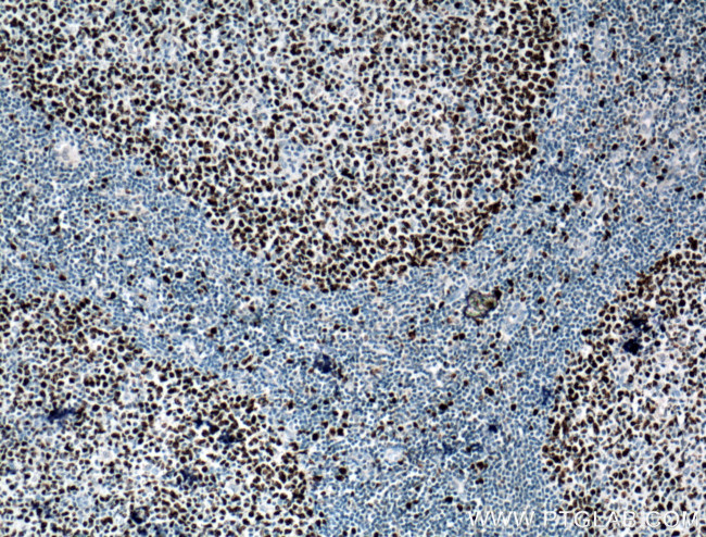 KI67 Antibody in Immunohistochemistry (Paraffin) (IHC (P))