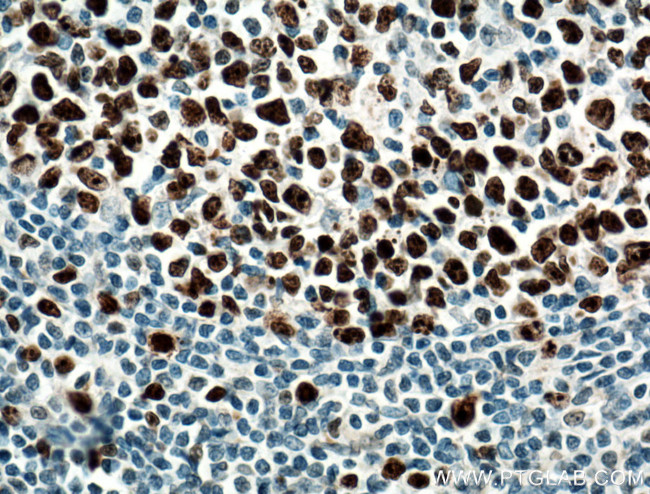 KI67 Antibody in Immunohistochemistry (Paraffin) (IHC (P))