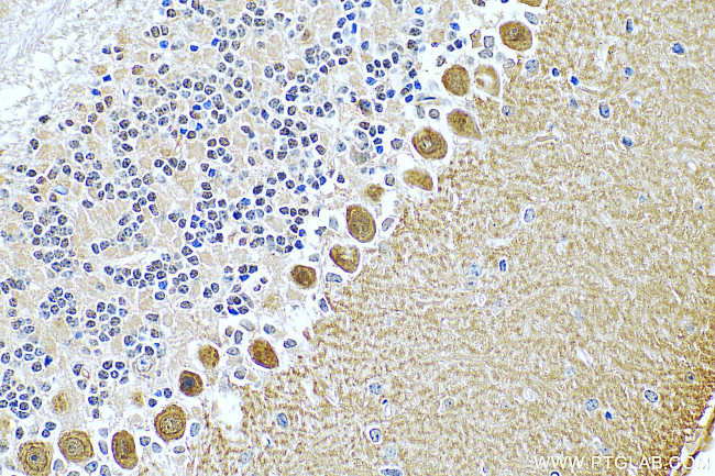 RGS8 Antibody in Immunohistochemistry (Paraffin) (IHC (P))