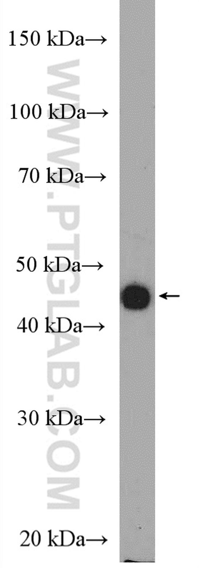 HLA-E Antibody in Western Blot (WB)