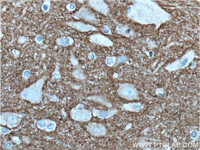 CACNA2D1 Antibody in Immunohistochemistry (Paraffin) (IHC (P))