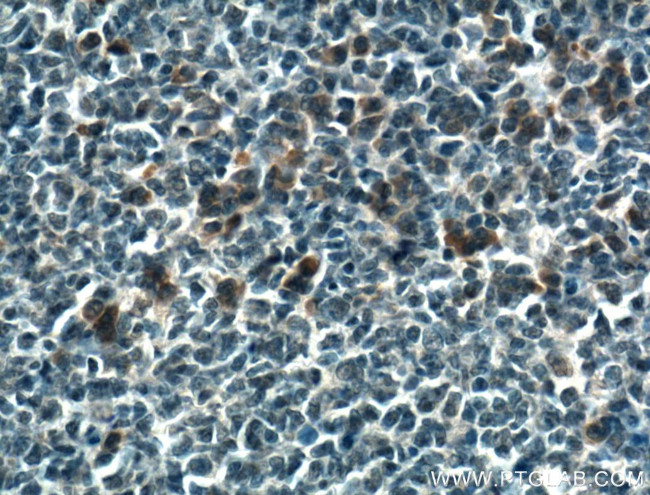 PDXP Antibody in Immunohistochemistry (Paraffin) (IHC (P))