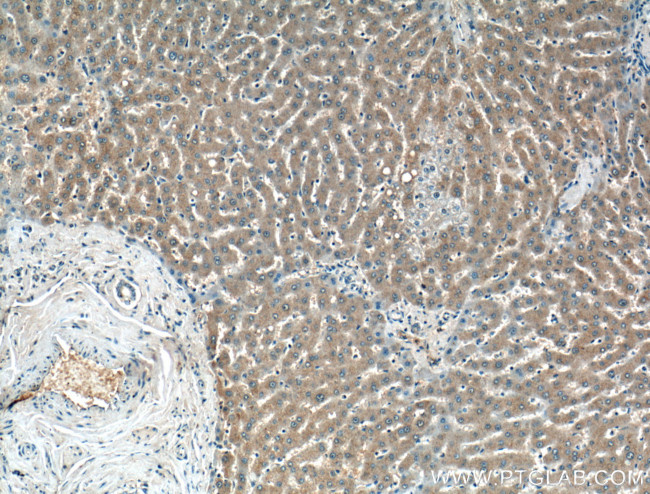 PDXP Antibody in Immunohistochemistry (Paraffin) (IHC (P))