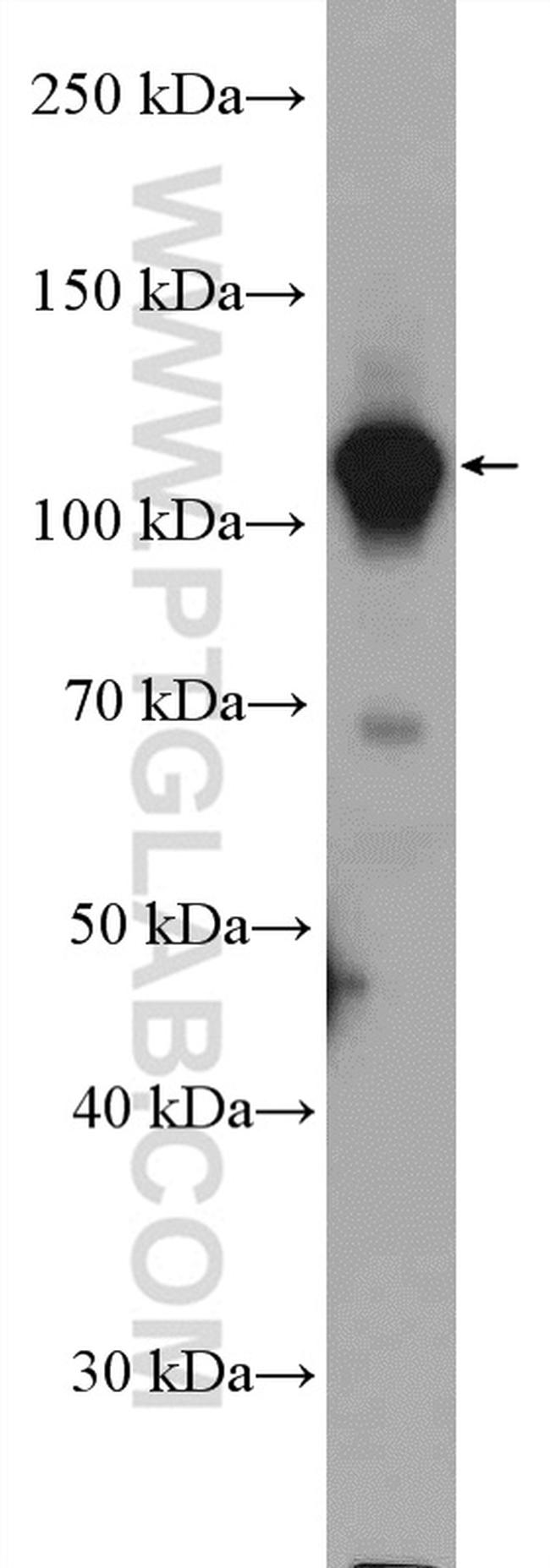 GTF3C2 Antibody in Western Blot (WB)
