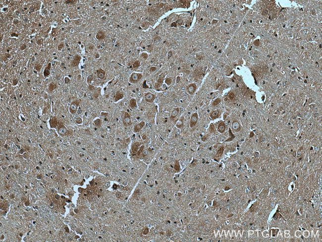 GABBR2 Antibody in Immunohistochemistry (Paraffin) (IHC (P))