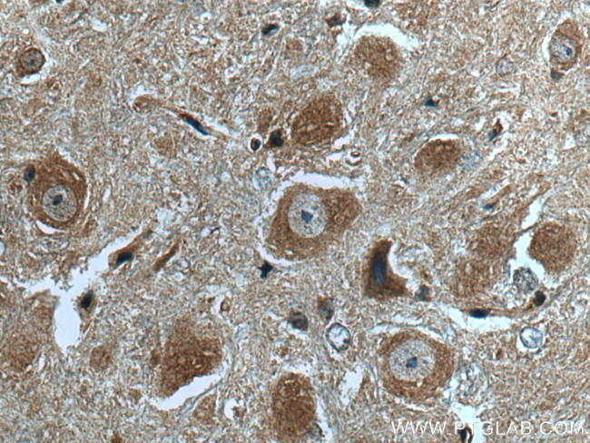 GABBR2 Antibody in Immunohistochemistry (Paraffin) (IHC (P))